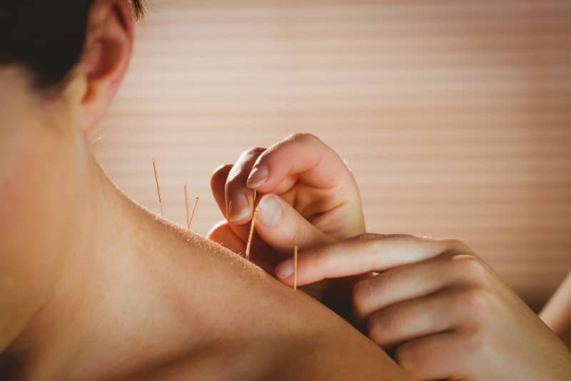 Acupuncture West Orange